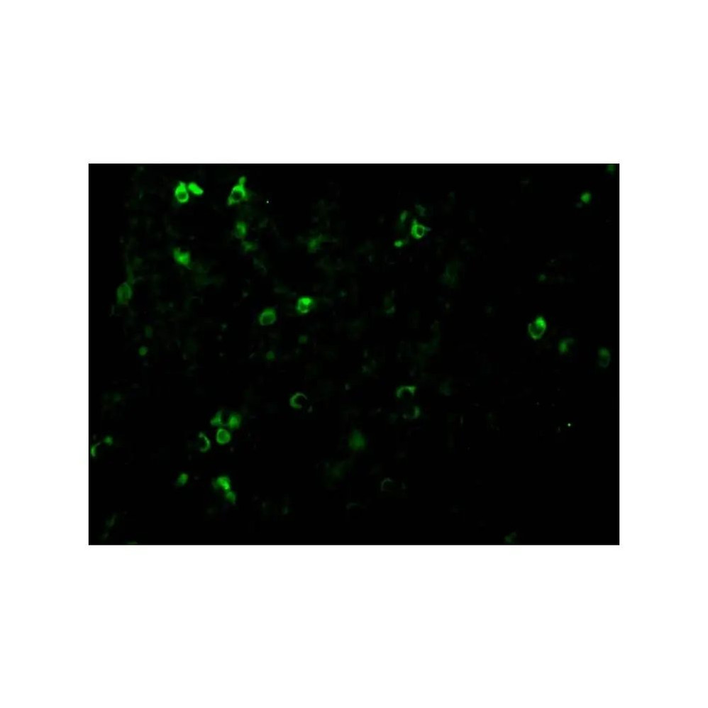 ProSci 2483 TCCR Antibody