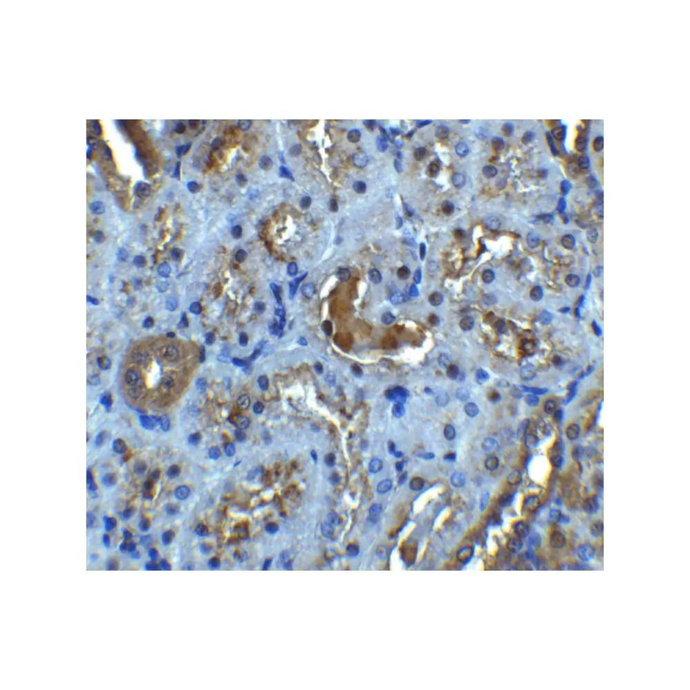 ProSci 2497 IL-22 Receptor Antibody