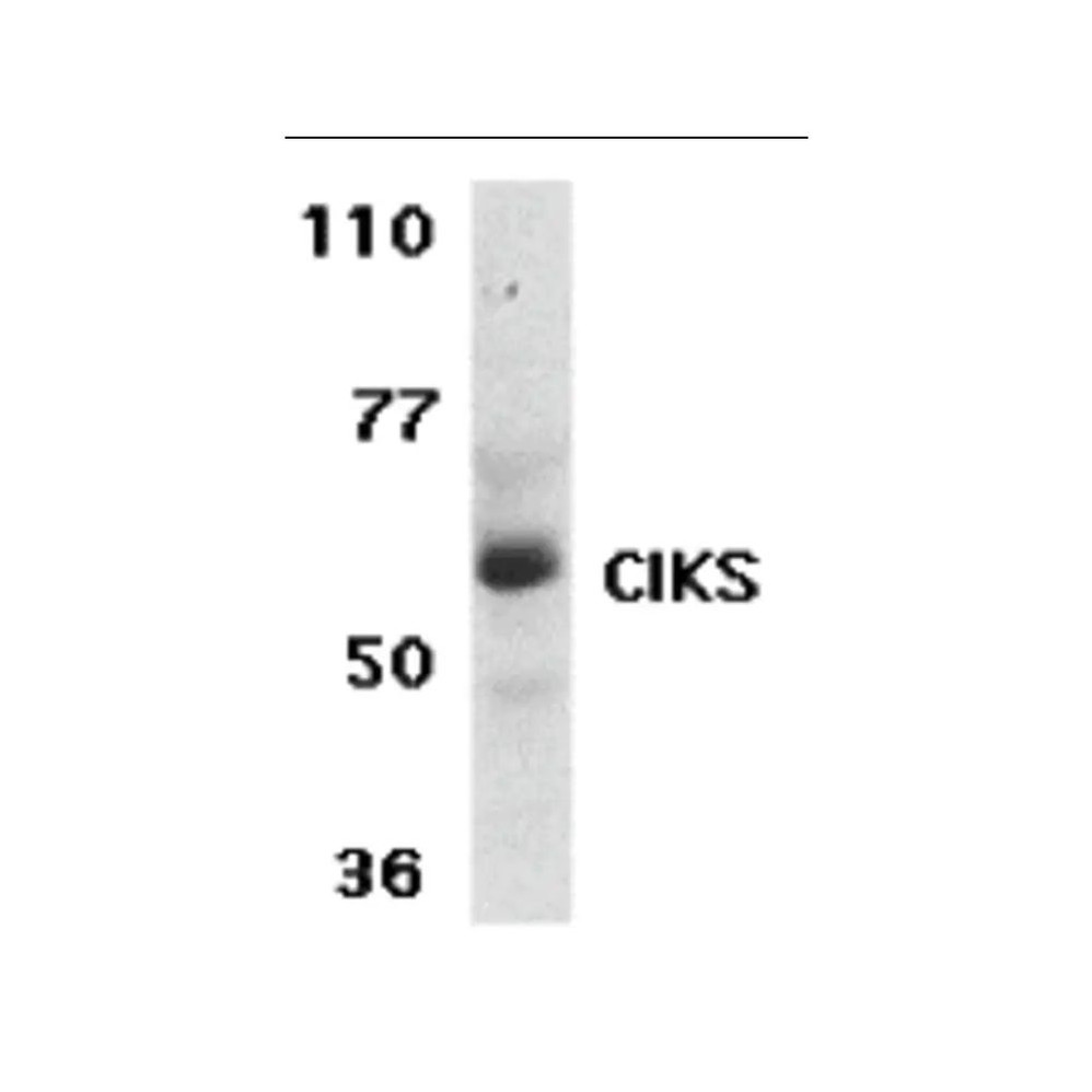 ProSci 2499 CIKS Antibody