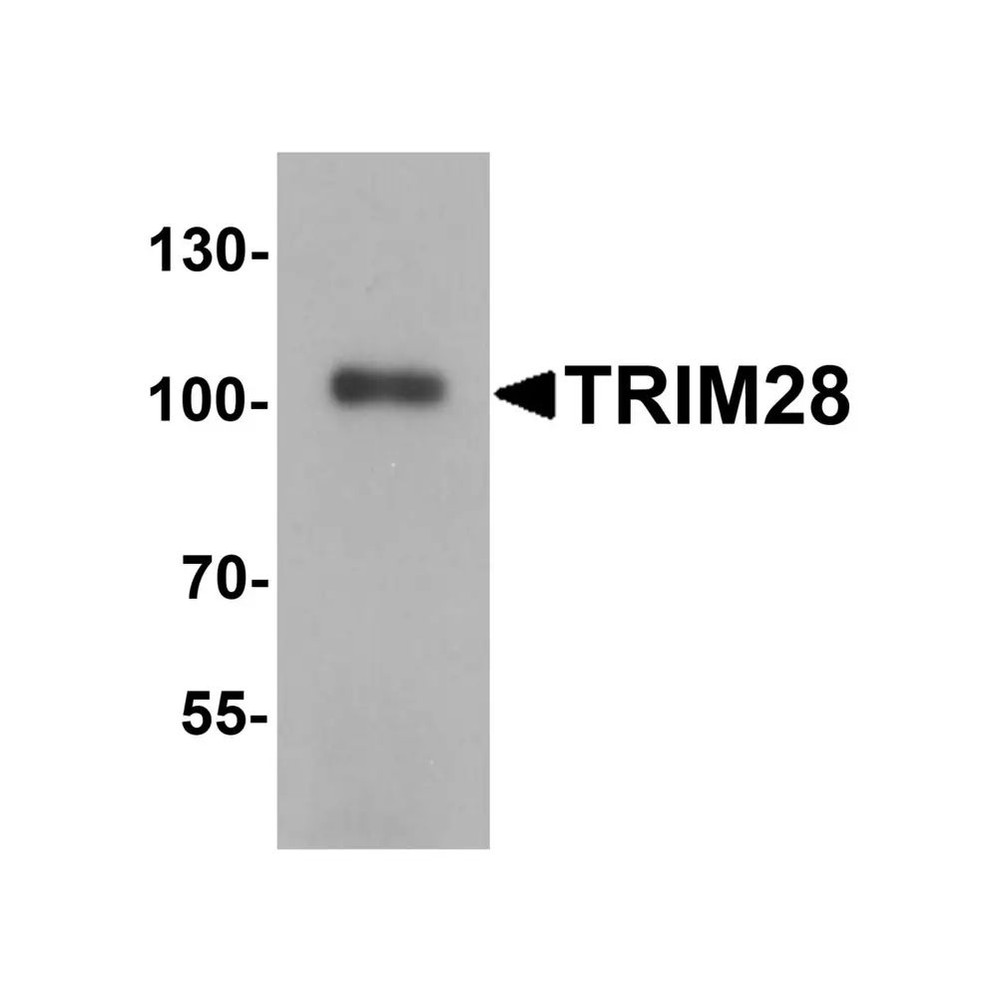 ProSci 2521 TRIM28 Antibody