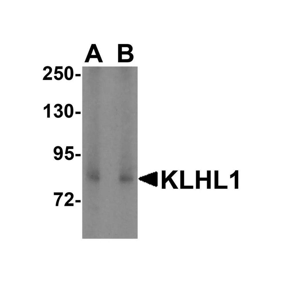 ProSci 3015 KLHL1 Antibody