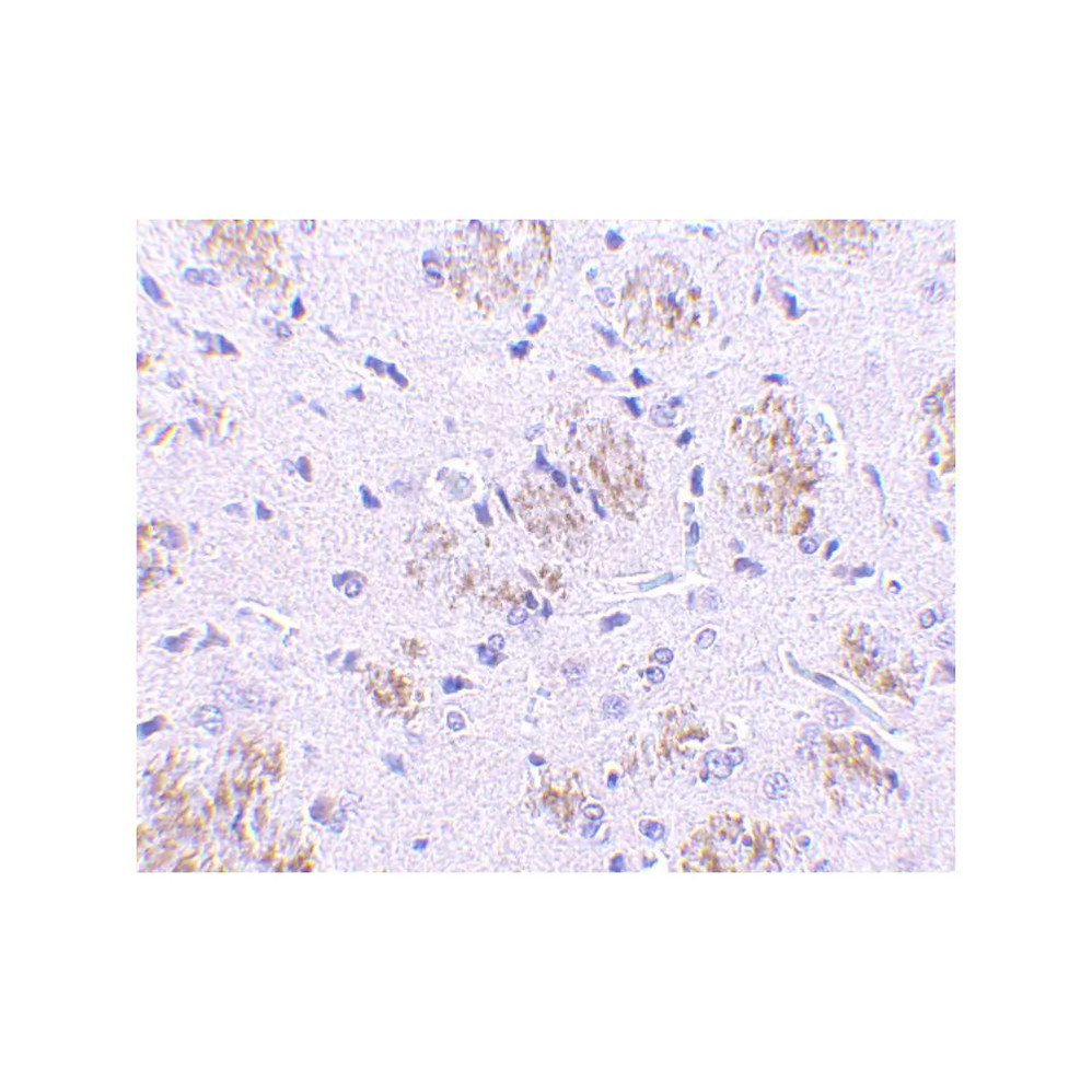 ProSci 3015 KLHL1 Antibody