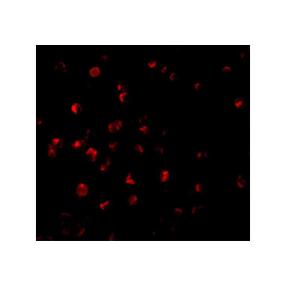 ProSci 3017 ILP-2 Antibody
