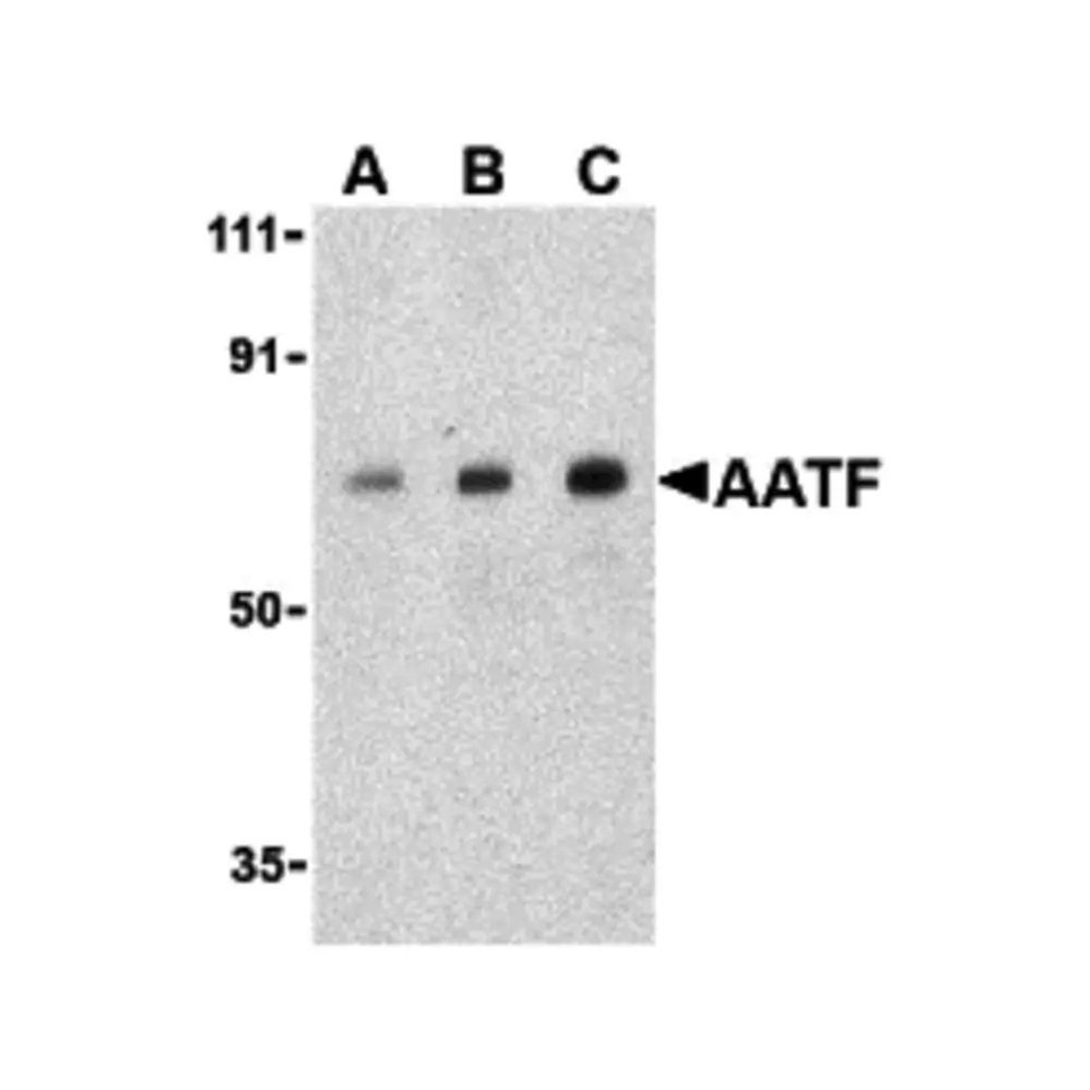 ProSci 3039 AATF Antibody
