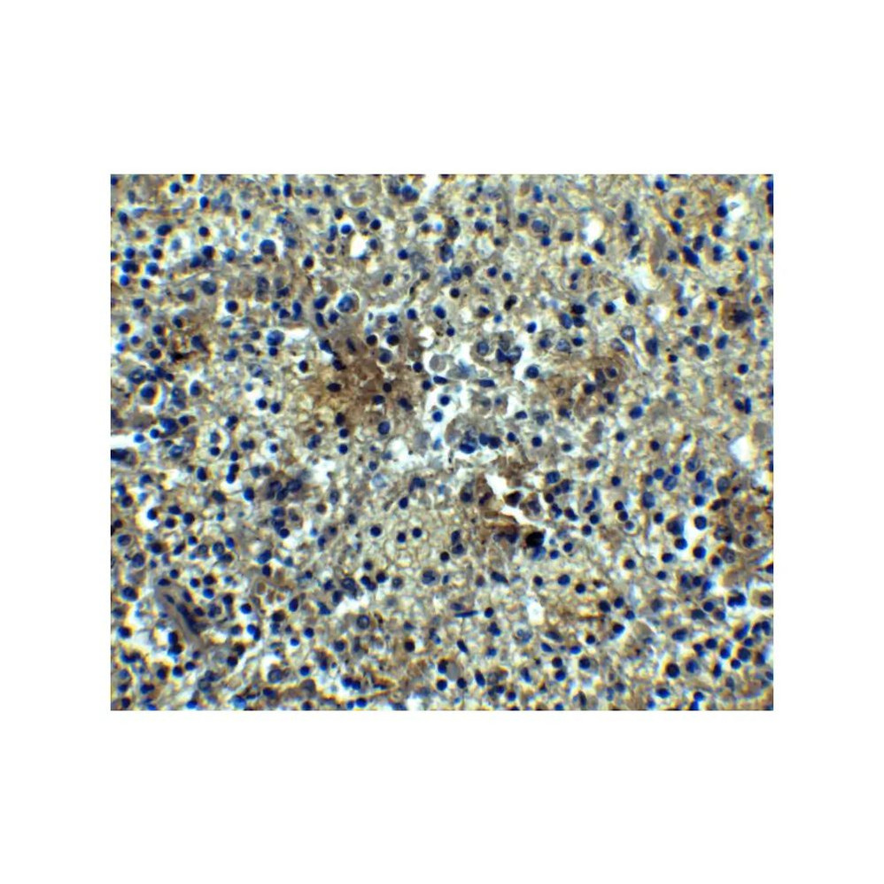 ProSci 3097 BAFF Receptor Antibody