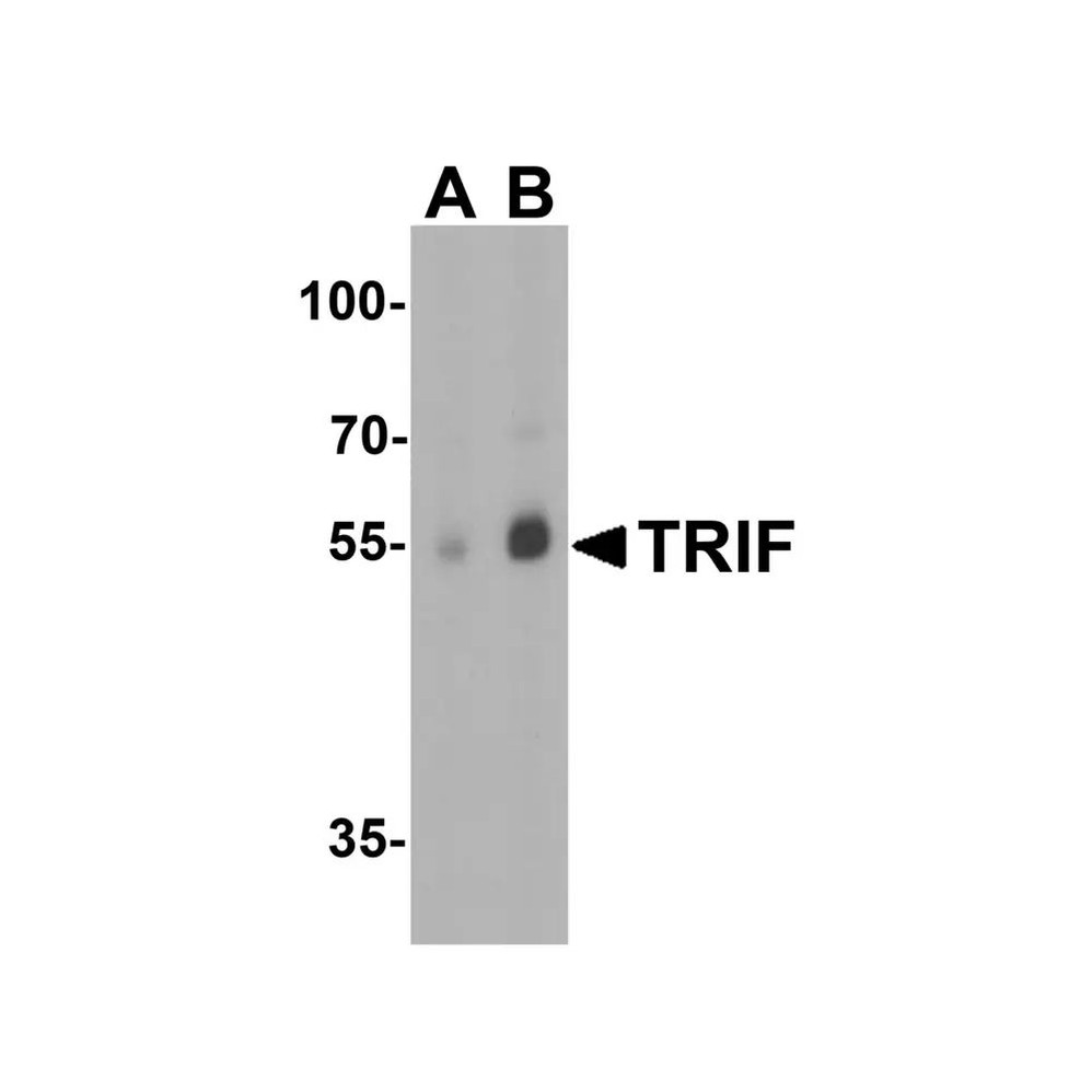 ProSci 3173 TRIF Antibody
