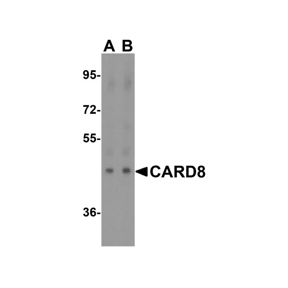 ProSci 3187 CARD8 Antibody