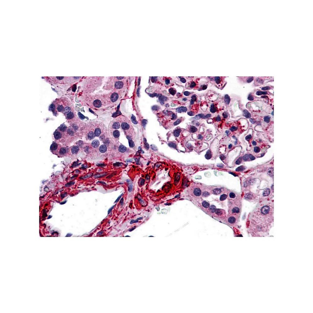 ProSci 3193 CARMA3 Antibody