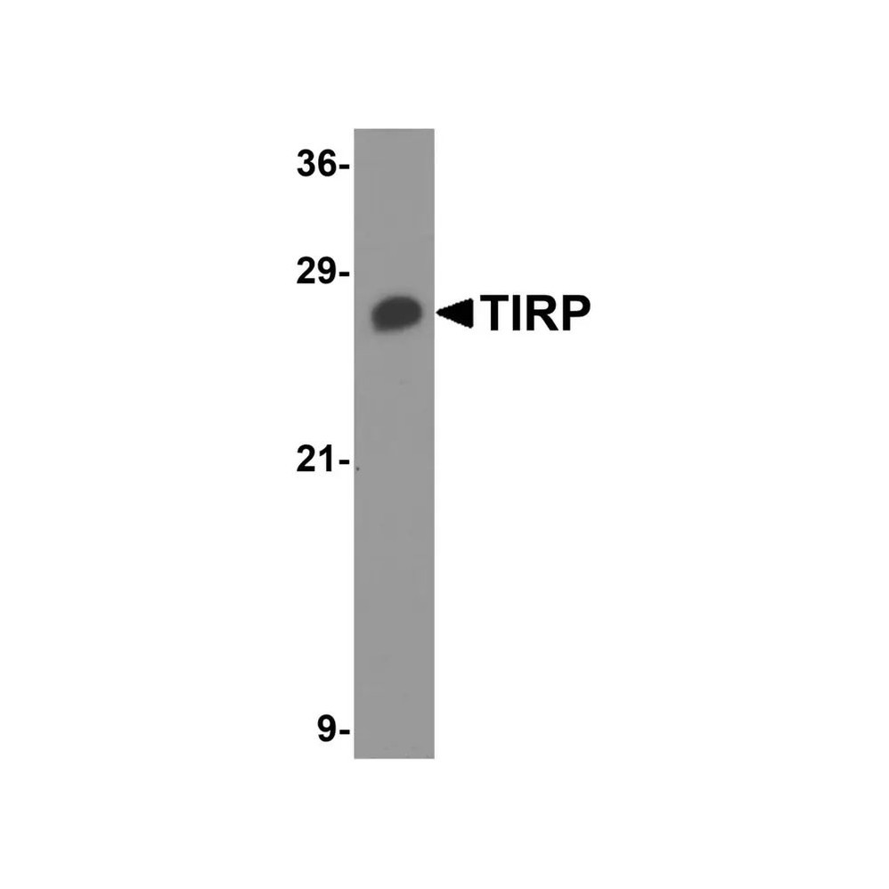 ProSci 3206 TIRP Antibody