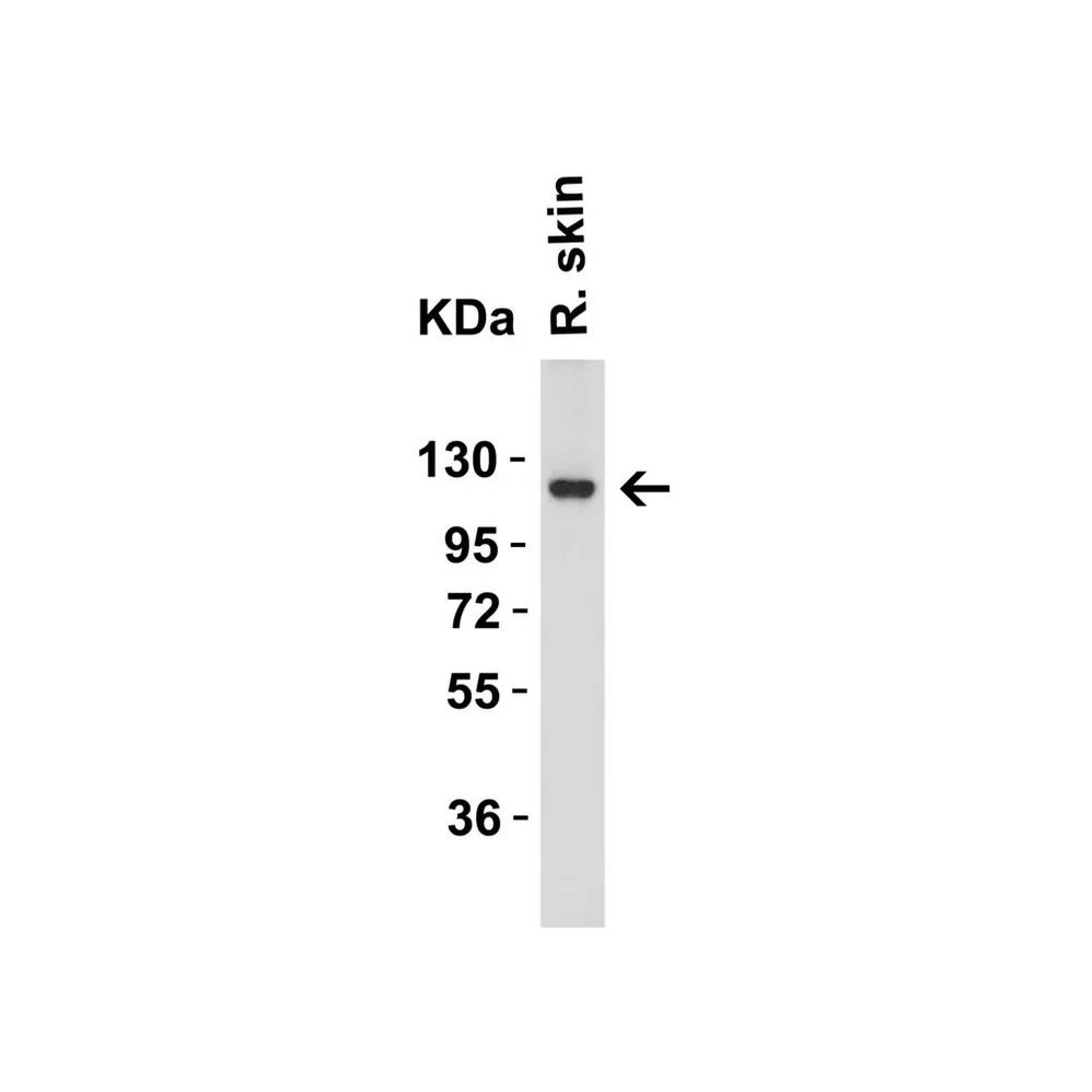 ProSci 3215 ACE2 Antibody