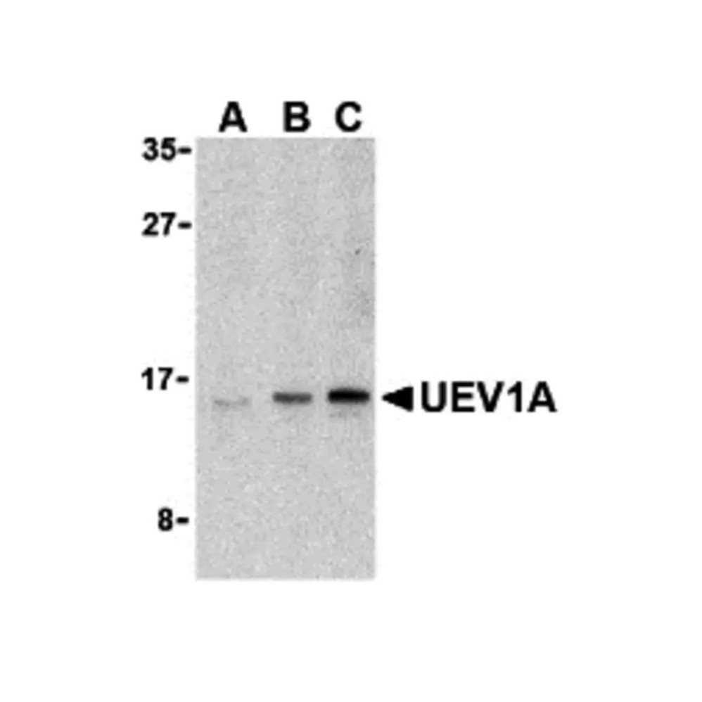 ProSci 3375 UEV1A Antibody