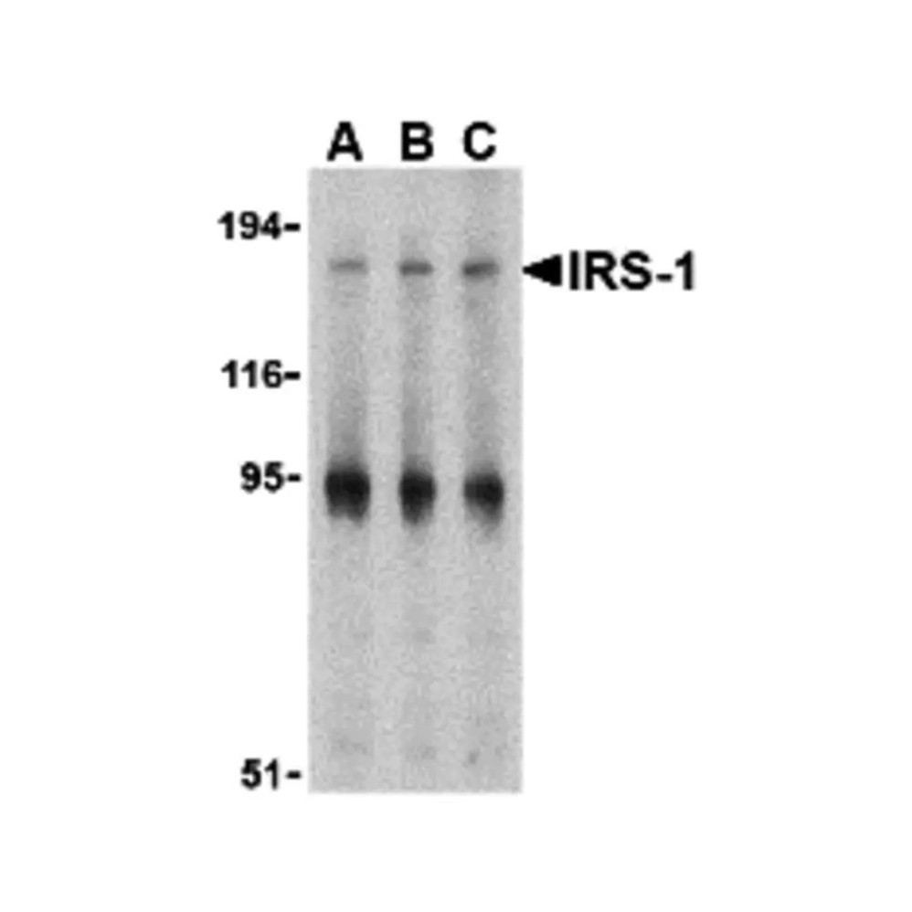 ProSci 3521 IRS-1 Antibody
