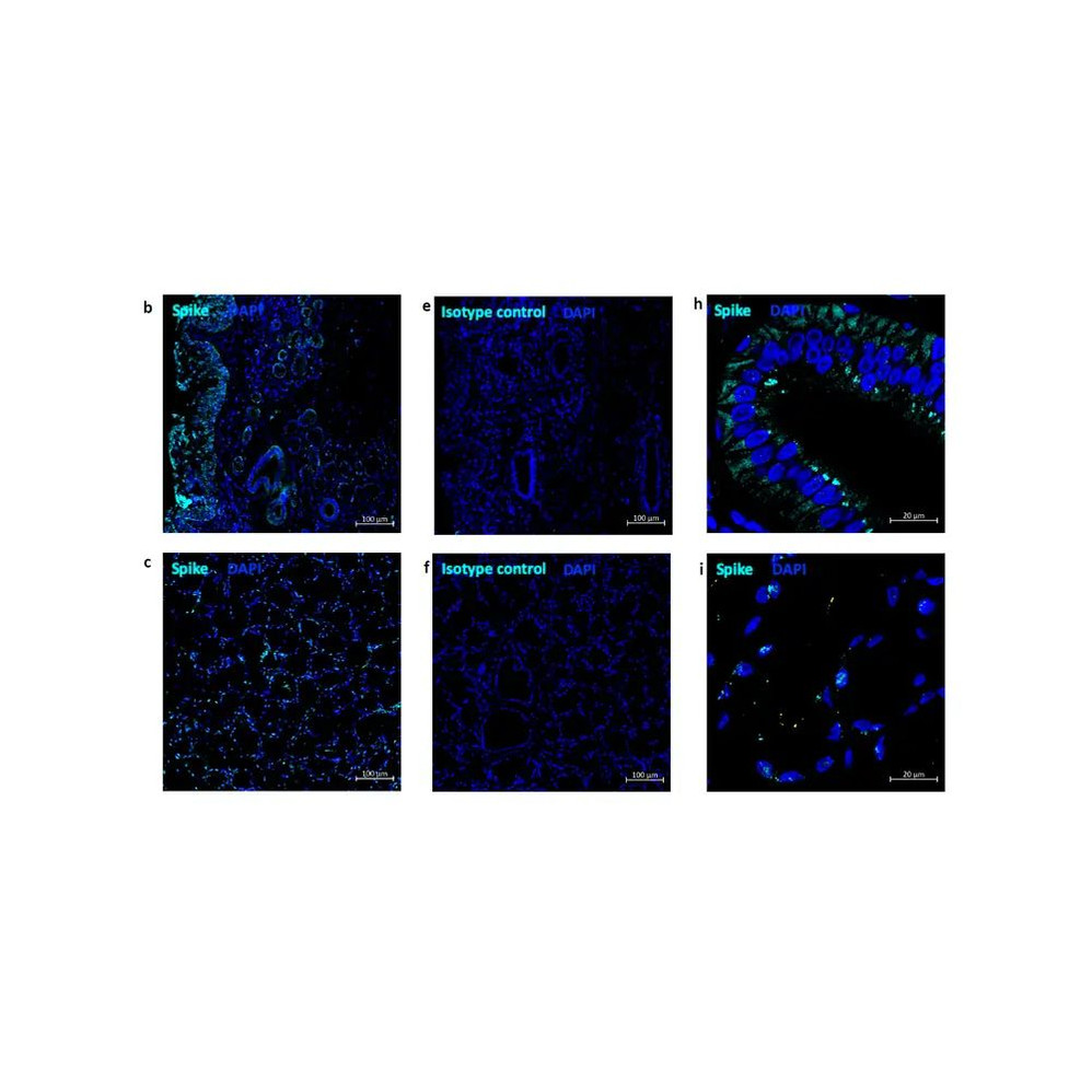 ProSci 3525 SARS-CoV-2 (COVID-19) Spike Antibody