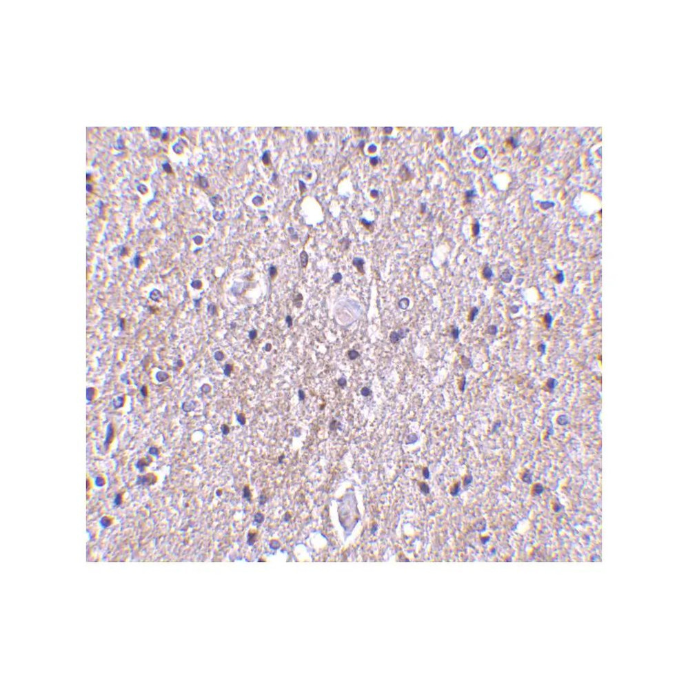 ProSci 3569 CTRP4 Antibody
