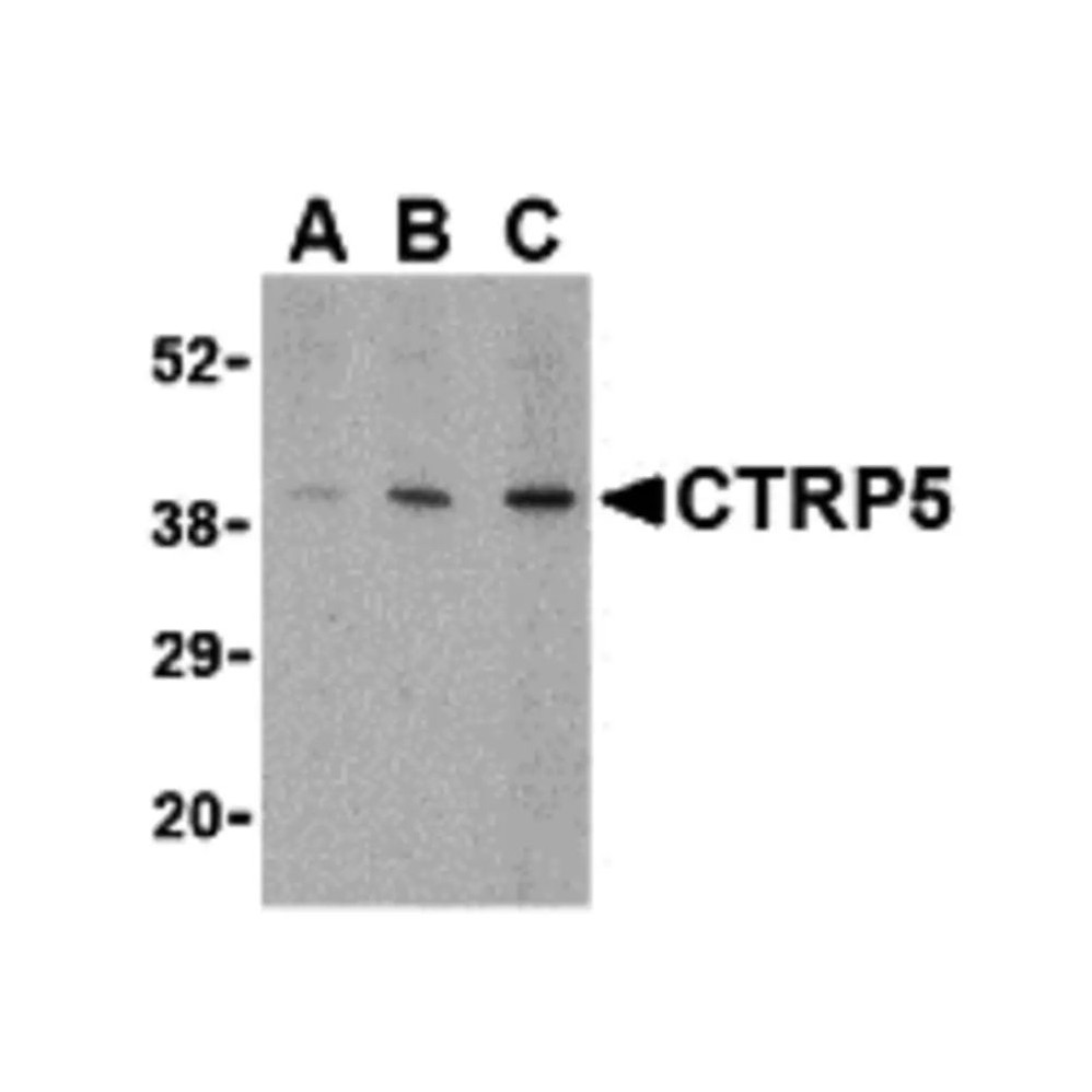 ProSci 3573 CTRP5 Antibody