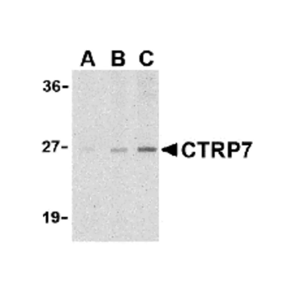 ProSci 3581 CTRP7 Antibody