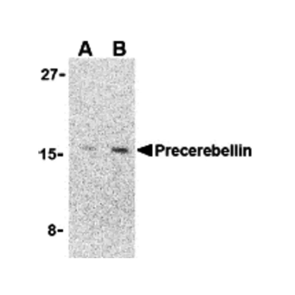 ProSci 3587 Precerebellin Antibody