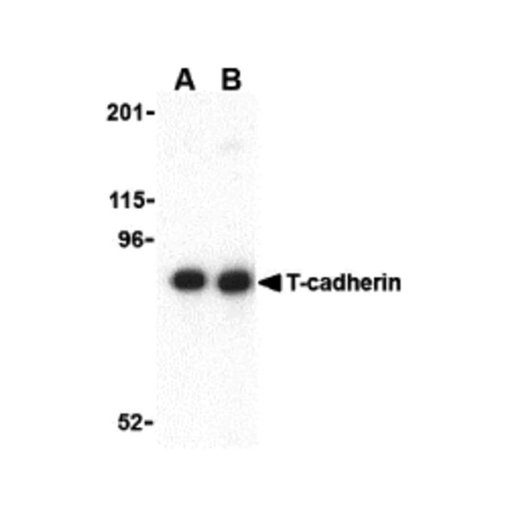 ProSci 3583 T-cadherin Antibody