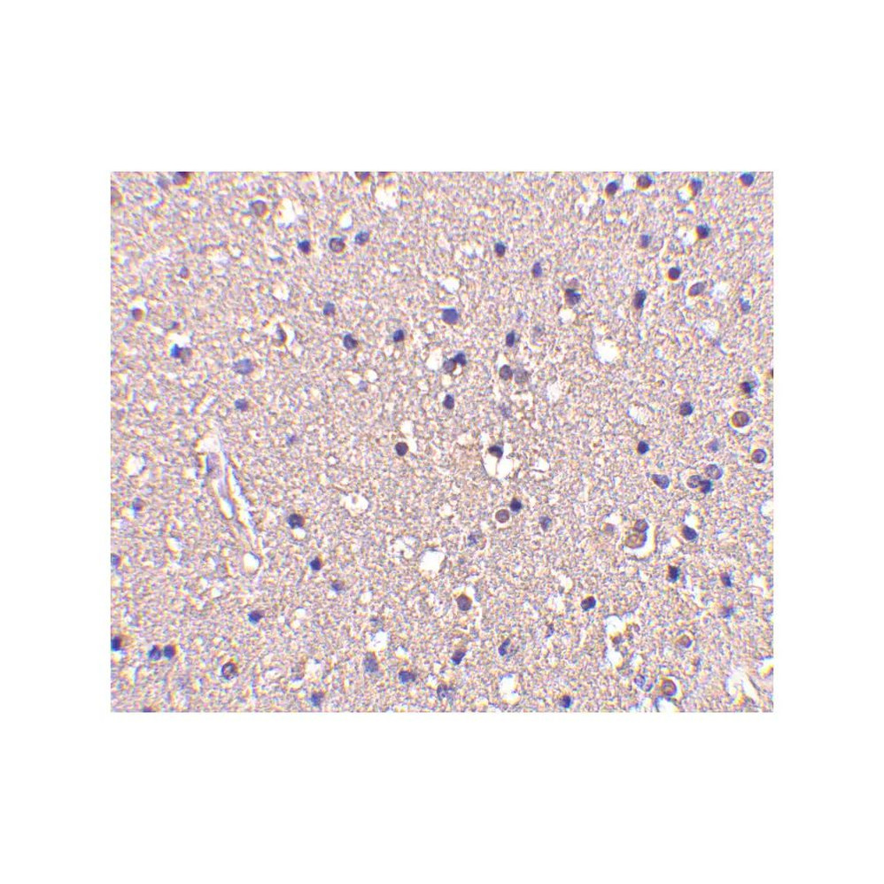 ProSci 3625 CRMP1 Antibody