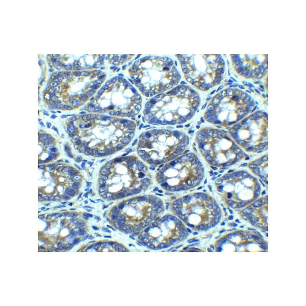 ProSci 3629 LAMP-1 Antibody