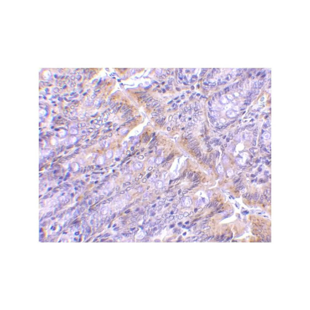 ProSci 3633 PIST Antibody