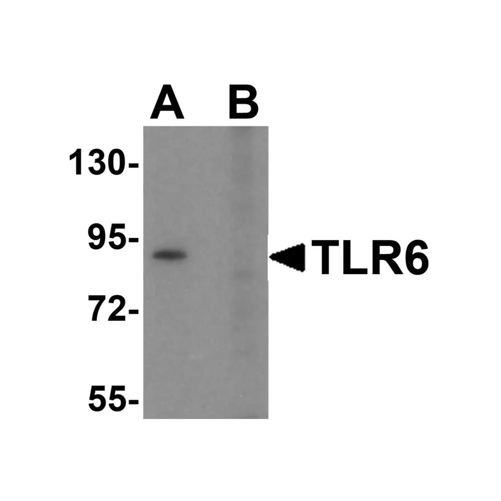 ProSci 3651 TLR6 Antibody