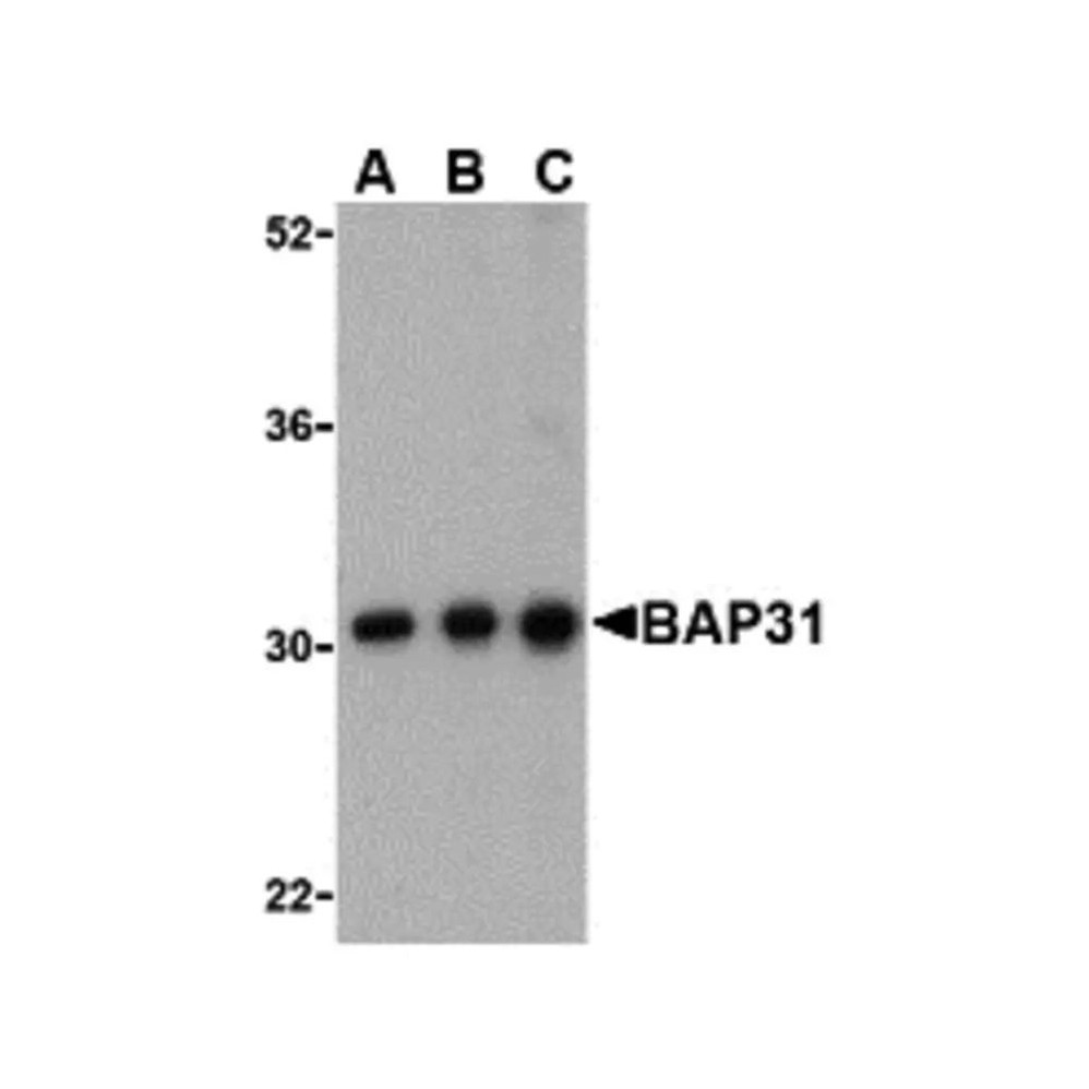 ProSci 3665 BAP31 Antibody
