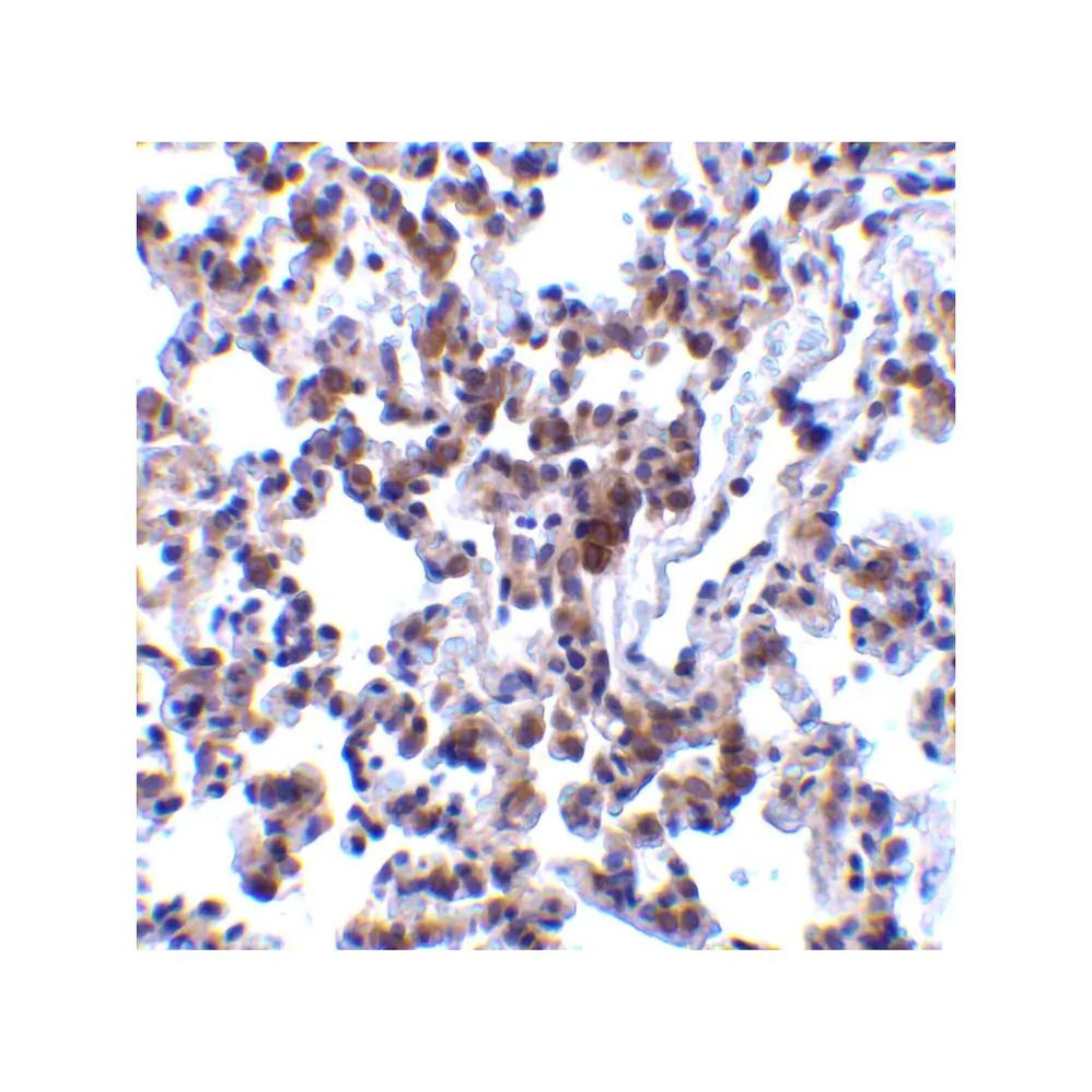 ProSci 3665 BAP31 Antibody