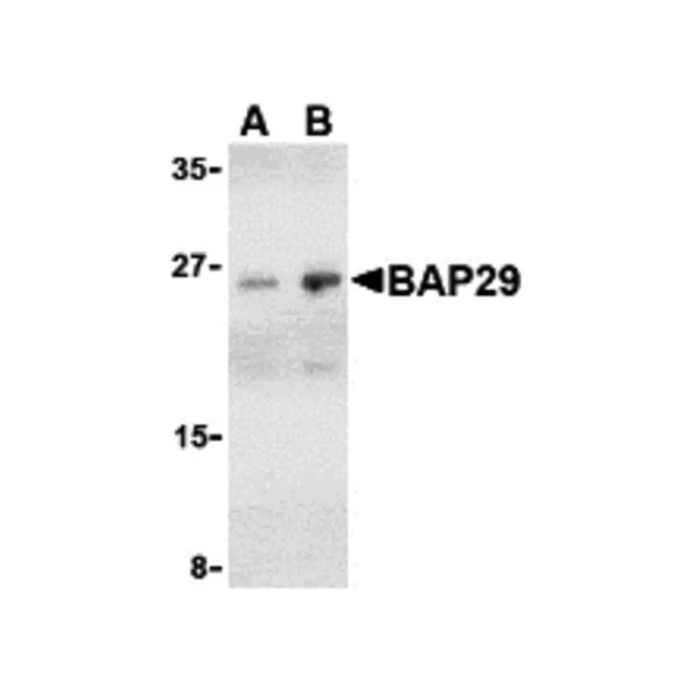 ProSci 3669 BAP29 Antibody