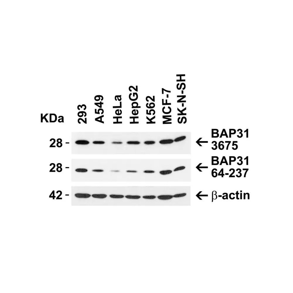 ProSci 3675 BAP31 Antibody