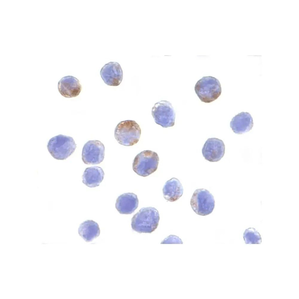 ProSci 3757 DDX3 Antibody