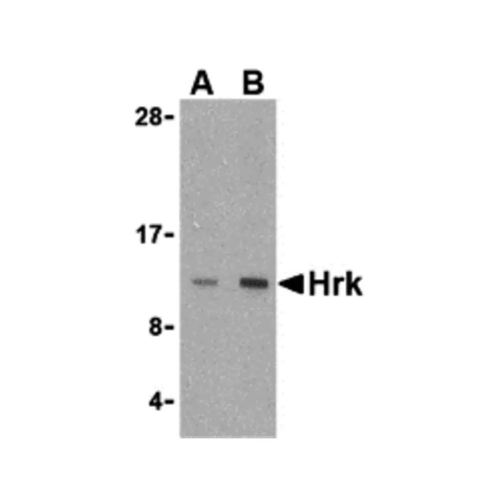 ProSci 3771 Hrk Antibody