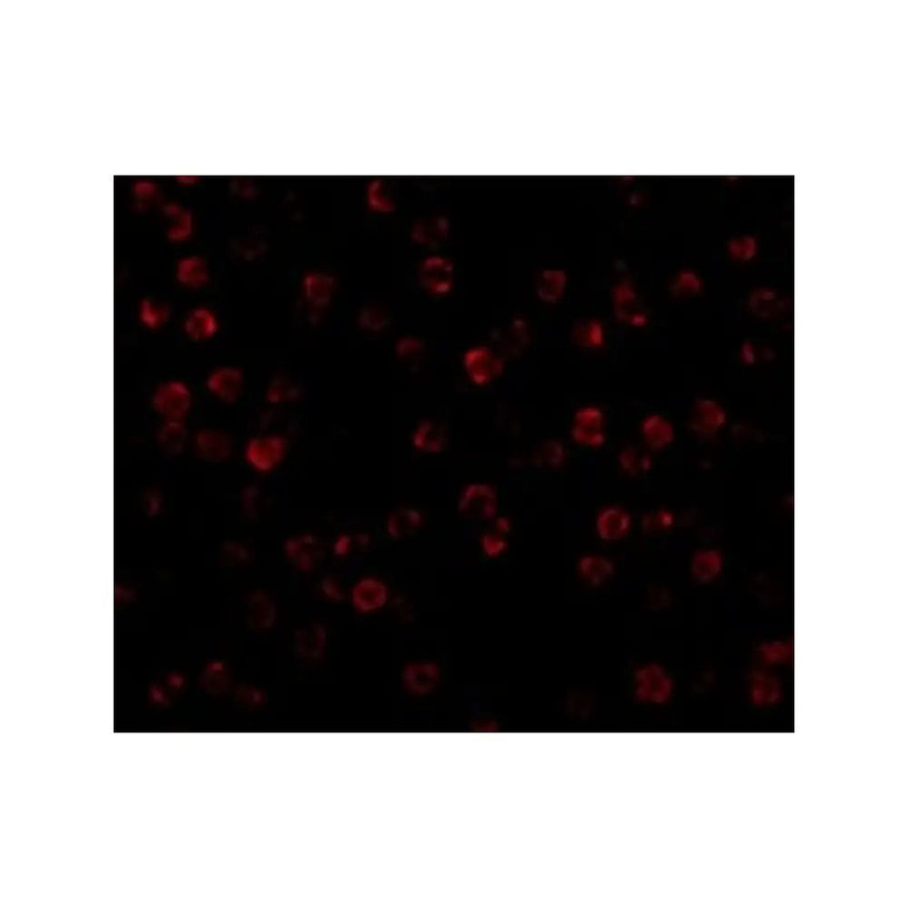 ProSci 3779 beta-Actin Antibody