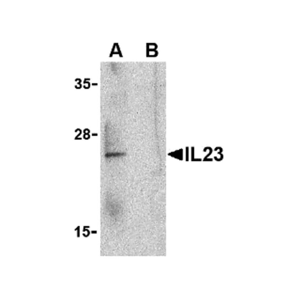 ProSci 3793 IL-23 Antibody