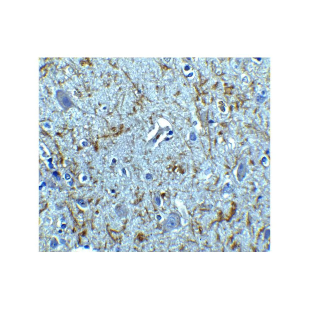 ProSci 3856 Clusterin Antibody
