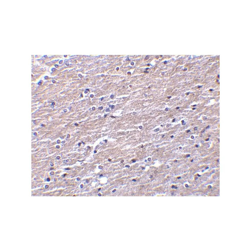 ProSci 3856 Clusterin Antibody