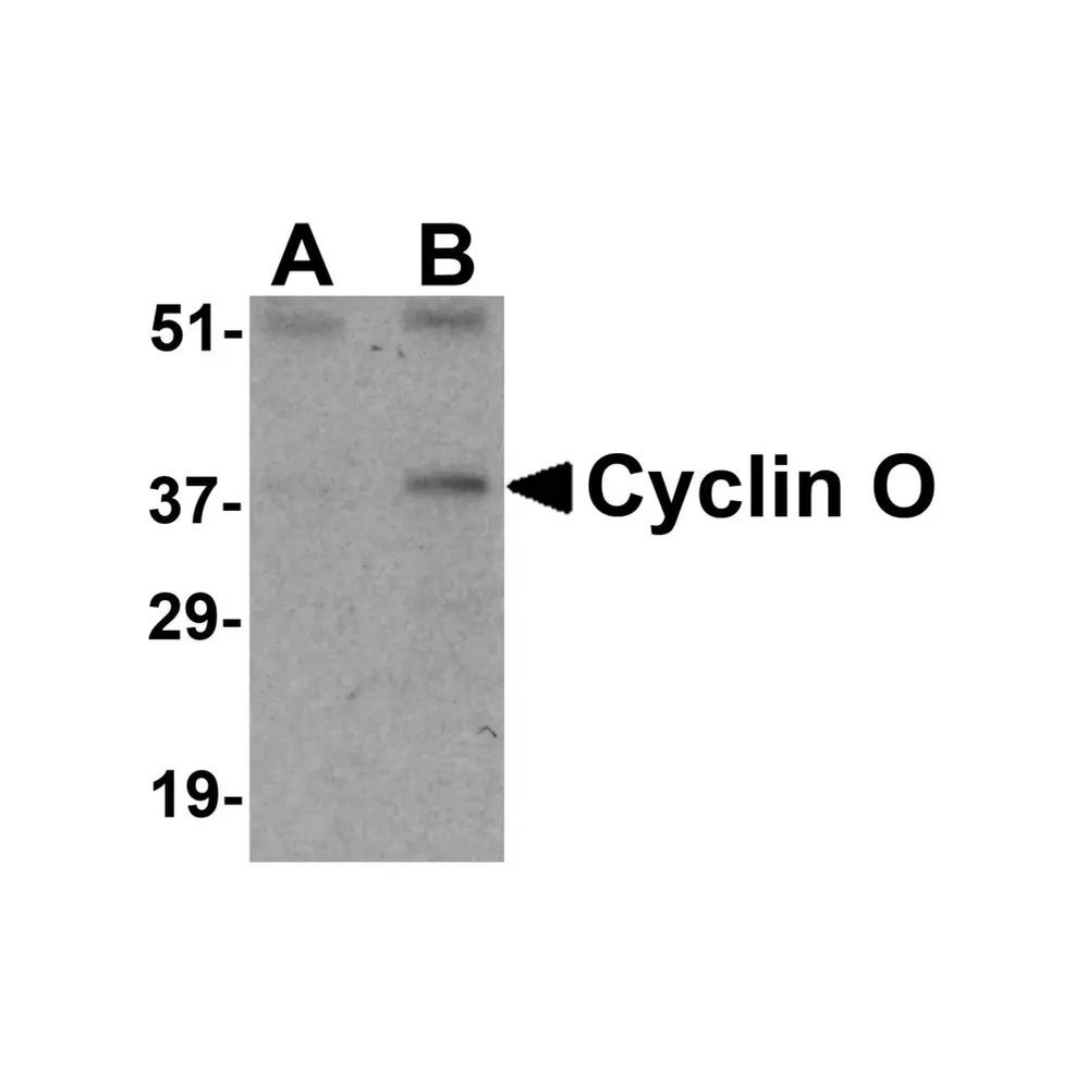 ProSci 3859 Cyclin O Antibody