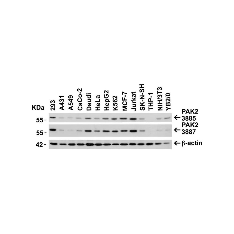 ProSci 3887 PAK2 Antibody