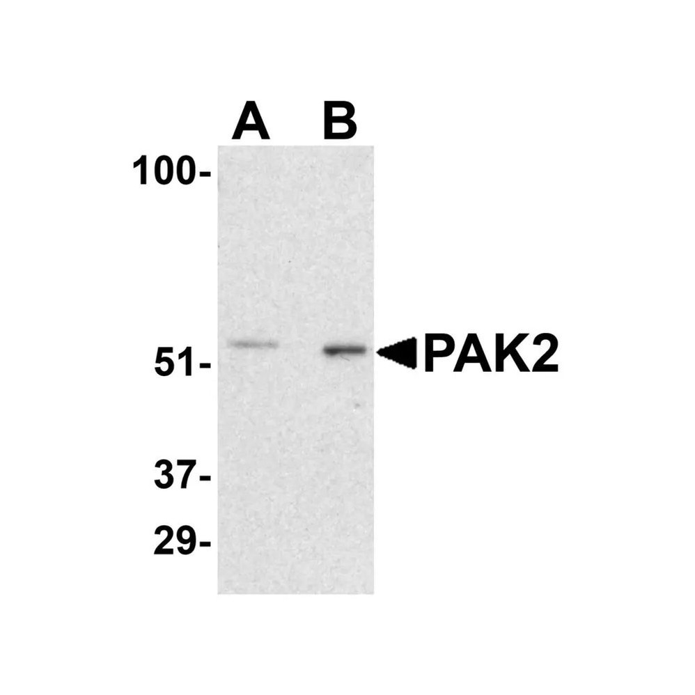 ProSci 3885 PAK2 Antibody