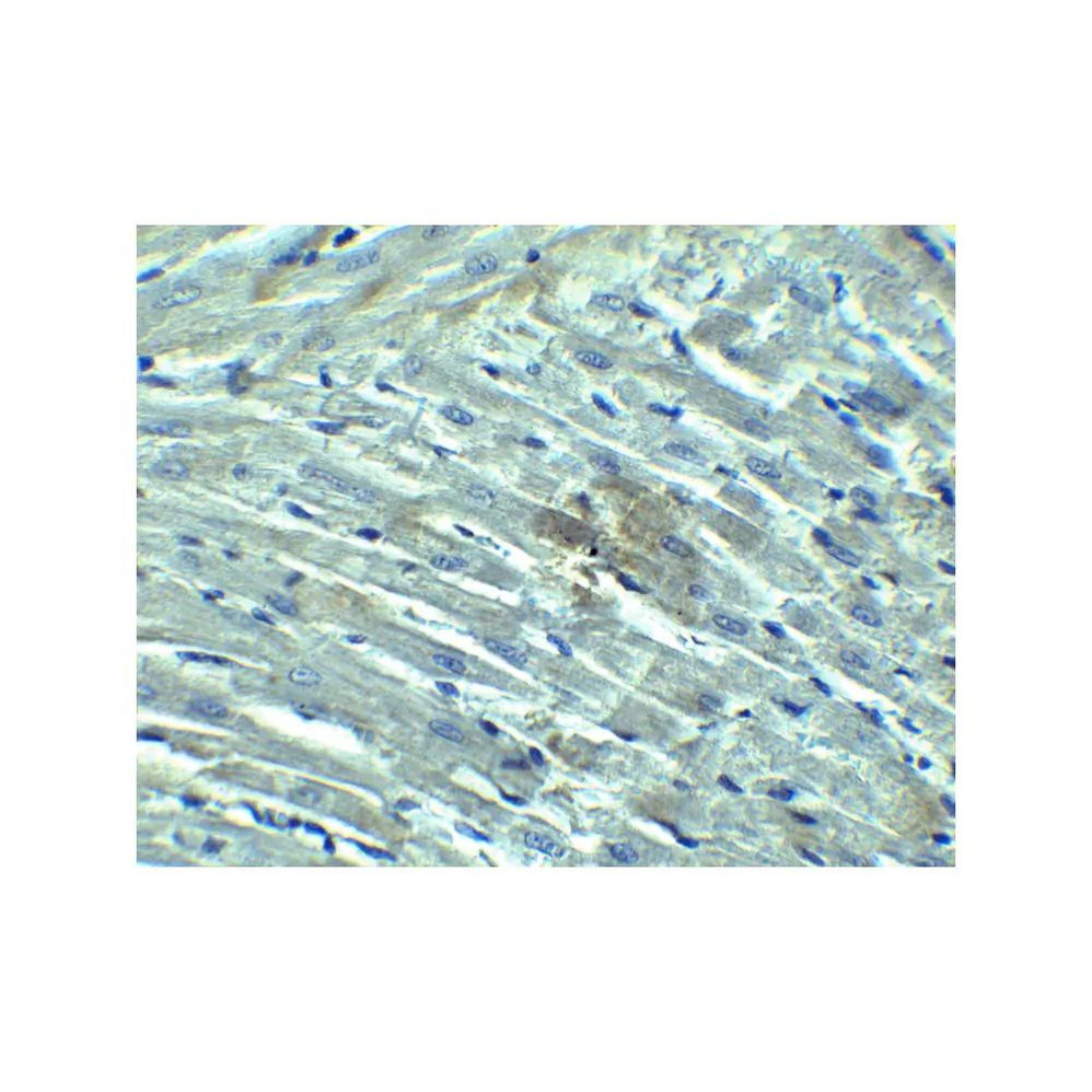 ProSci 3953 RIG-1 Antibody