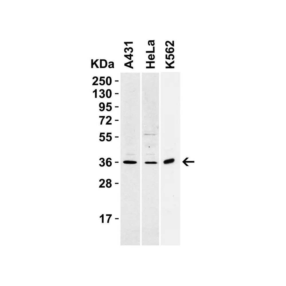ProSci 3963 sRANK Ligand Antibody