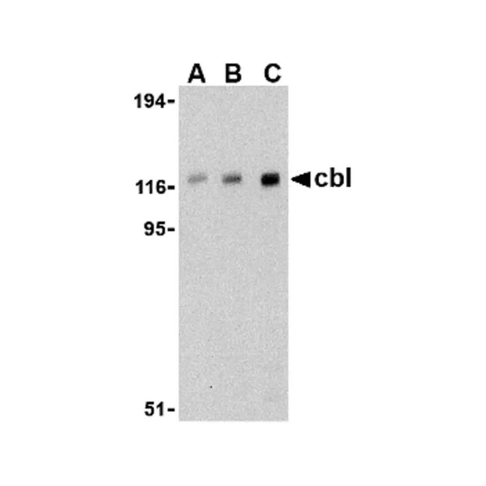 ProSci 3967 Cbl Antibody