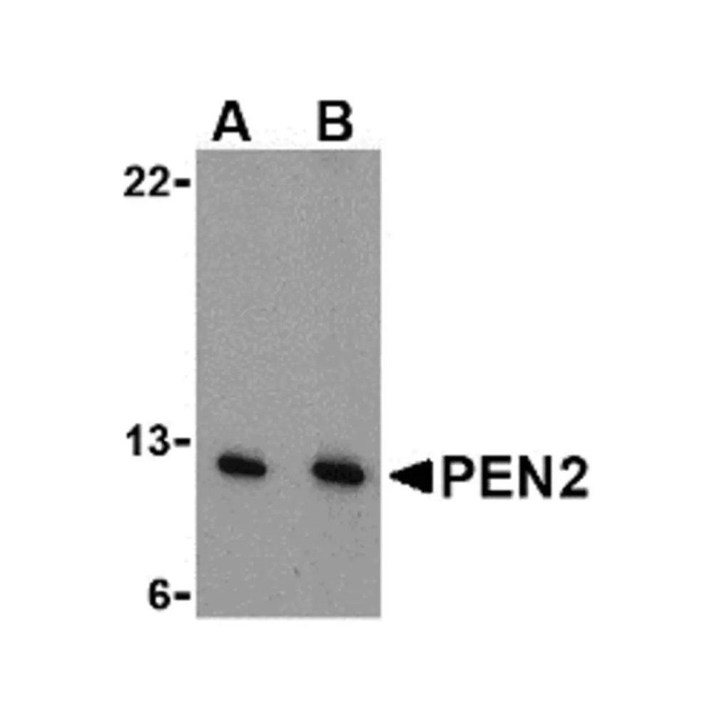 ProSci 3981 PEN2 Antibody