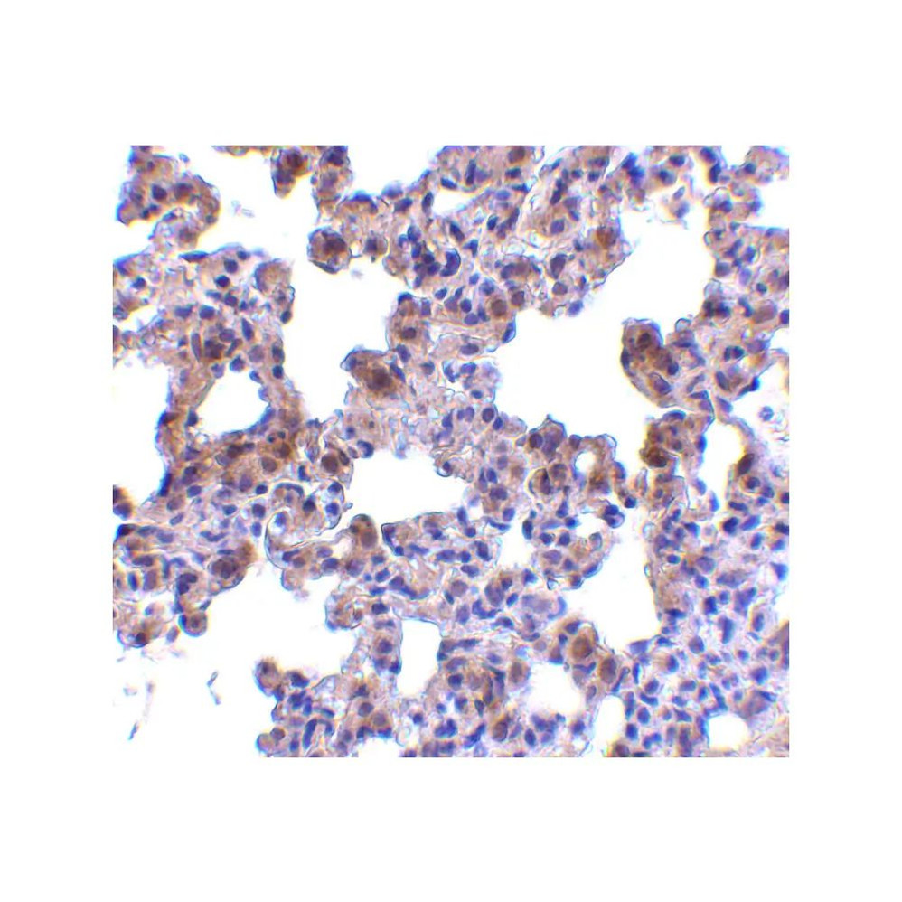 ProSci 3981 PEN2 Antibody