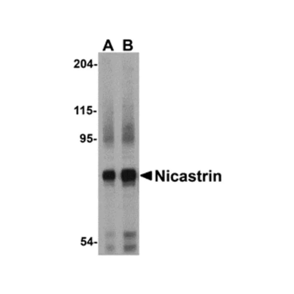 ProSci 3985 Nicastrin Antibody