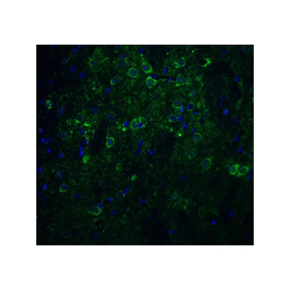 ProSci 3985 Nicastrin Antibody