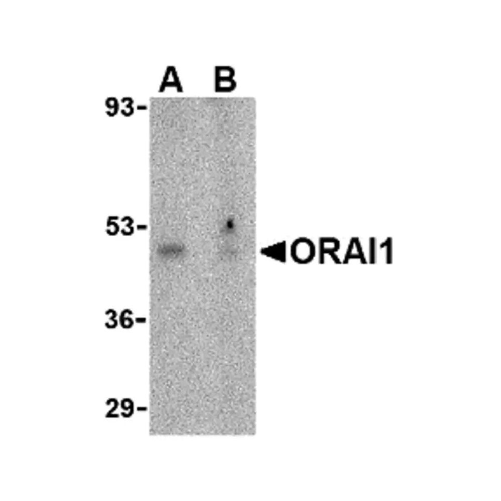 ProSci 4041 ORAI1 Antibody