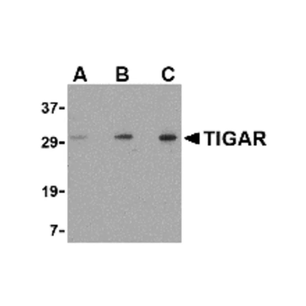 ProSci 4049 TIGAR Antibody