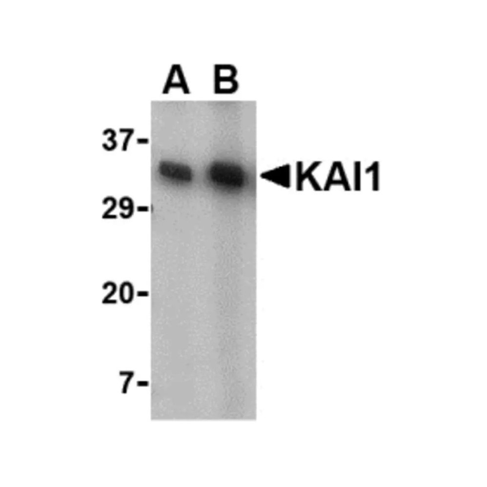 ProSci 4073 KAI1 Antibody