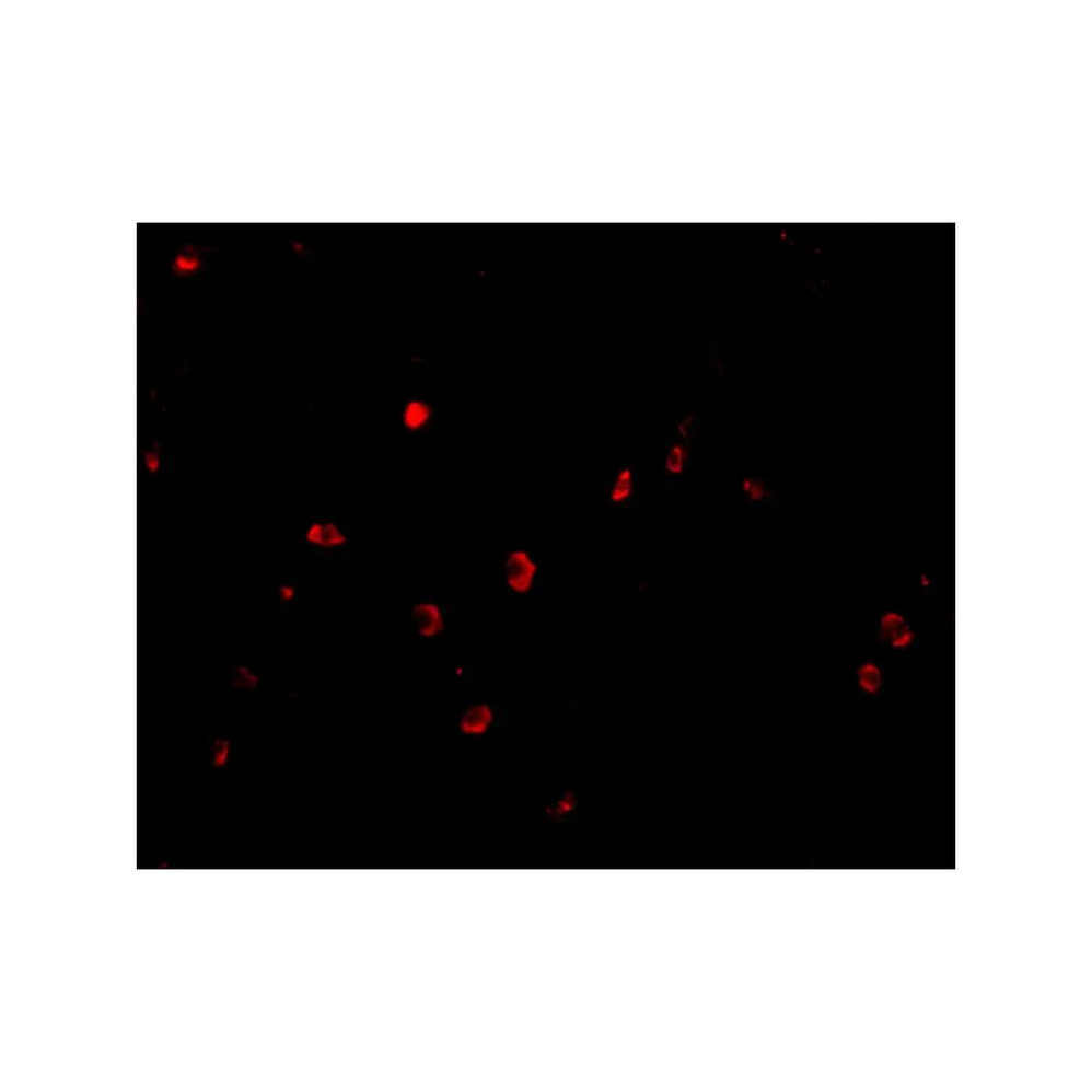 ProSci 4073 KAI1 Antibody